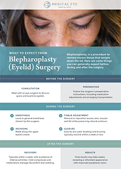 What-to-Expect-from-Blepharoplasty-(eyelid)-Surgery